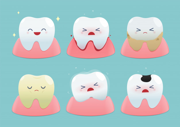 veneer gigi menyebabkan gusi bengkak