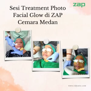 Sesi treatment photo facial glow zap cemara asri medan